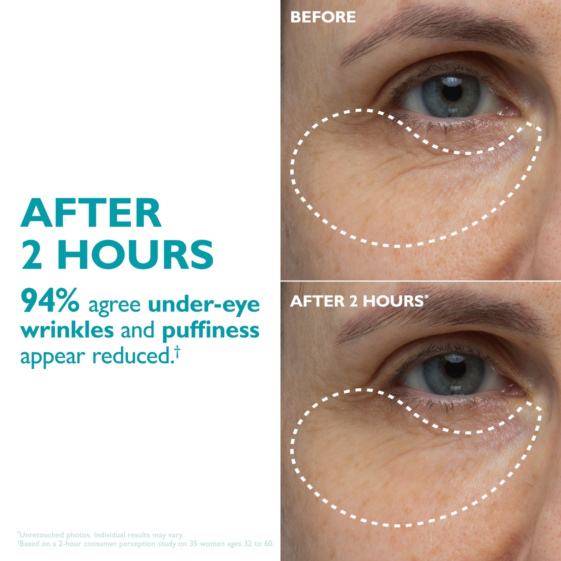 Peptide-Infused Face & Eye Tape